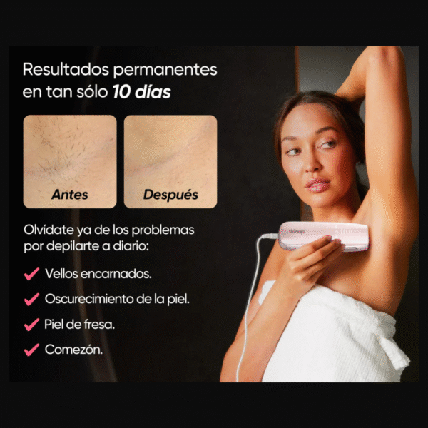 Láser permanente - Skinup Pro